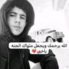 srag__75