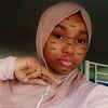 chay_na