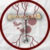 fleshengineer