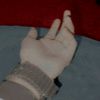 toxic_lrka2