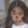 vimzon.6