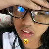 elisyndrome