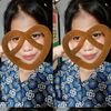 xxylasma