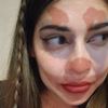 alcogabb