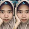 _smnis