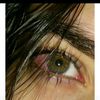 elsad2t