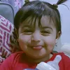 sahla_alopedi