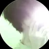 ty6ro