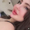 i_papula3
