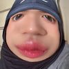 na.unnaaa_