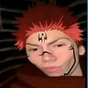 kydalbert