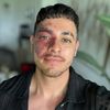 eddie_botijas