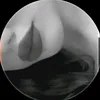 1ms_.m