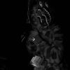 freedag_