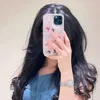 zm_xm00