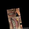 sosamedranda3