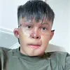 Thái Sẹo