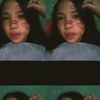 anomaliwcancii