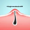 ingrownhairs09