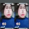 nho_anhmd