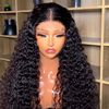 _omas_hairline