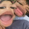 kityysiudepgai