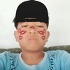alprckk