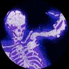 bones2308