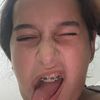 scar_helf