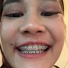 ipoo2213