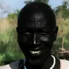 neckhurt213767
