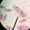 fhagositosis
