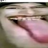 skilisu3