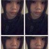 nat_.naxx