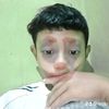 wicilz_2