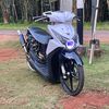 sirosis_45