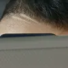 amir_bfd