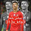 313x_kfa3