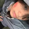 ypg_agp