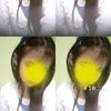 listyo_4