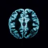 NeuroTrace