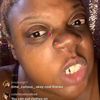tyrabanksforehead