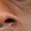 osasio_leftnostril