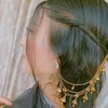 MiشAL