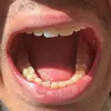 dentalkyy