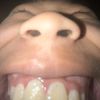phupa560