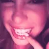nbg__335