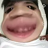 dangauma