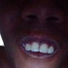 yellowteeth_4.0