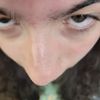 monkeypoxx5